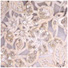 Embroidered Fabric with Cut work Embroidered Fabric with Cut work